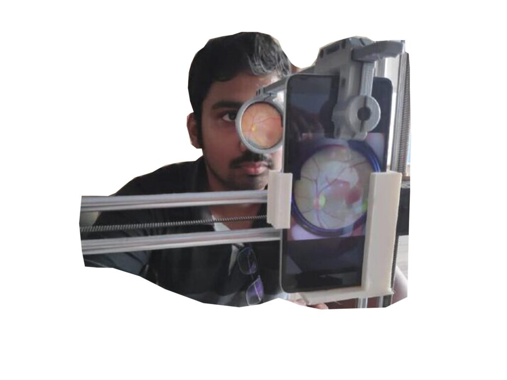 AI Eye robotic eye doctor by Mohan Venkadesan and Siddharth KK