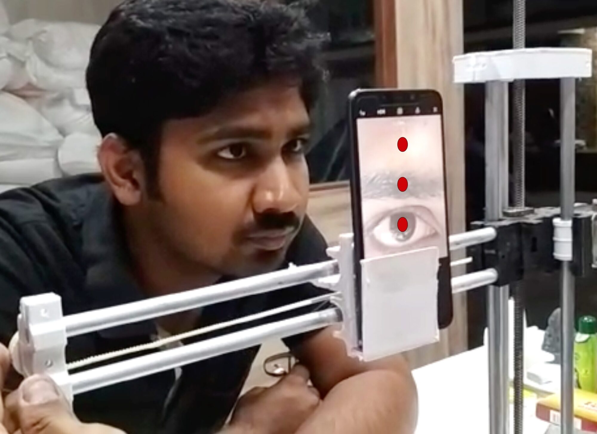 Mohan Venkadesan 5 AI Squint Screener MohanVenkadesan